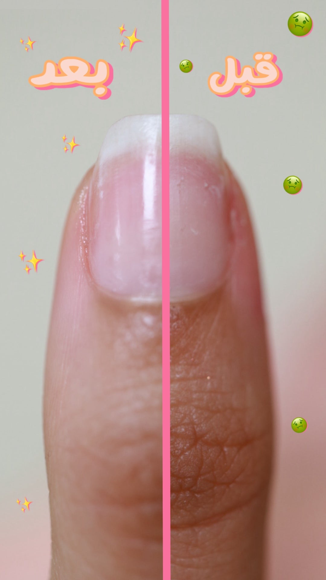 gummy nail file